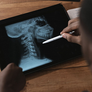 Прямой эфир с ортопедом-травматологом: "Нарушения в шейном отделе позвоночника (атланто-аксиальном сочленении) у детей с синдромом Дауна” 